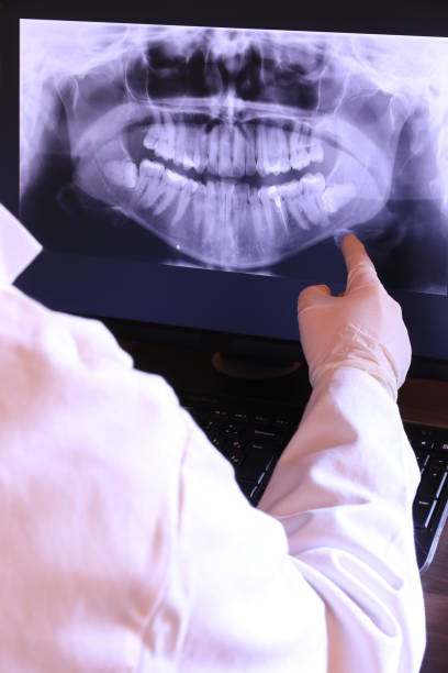 Best Emergency Dental Care for Broken or Chipped Teeth in Pender, NE