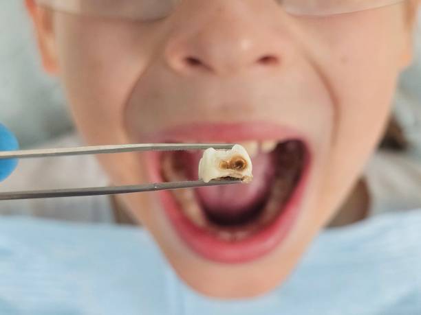 Best Pediatric Emergency Dentist in Pender, NE